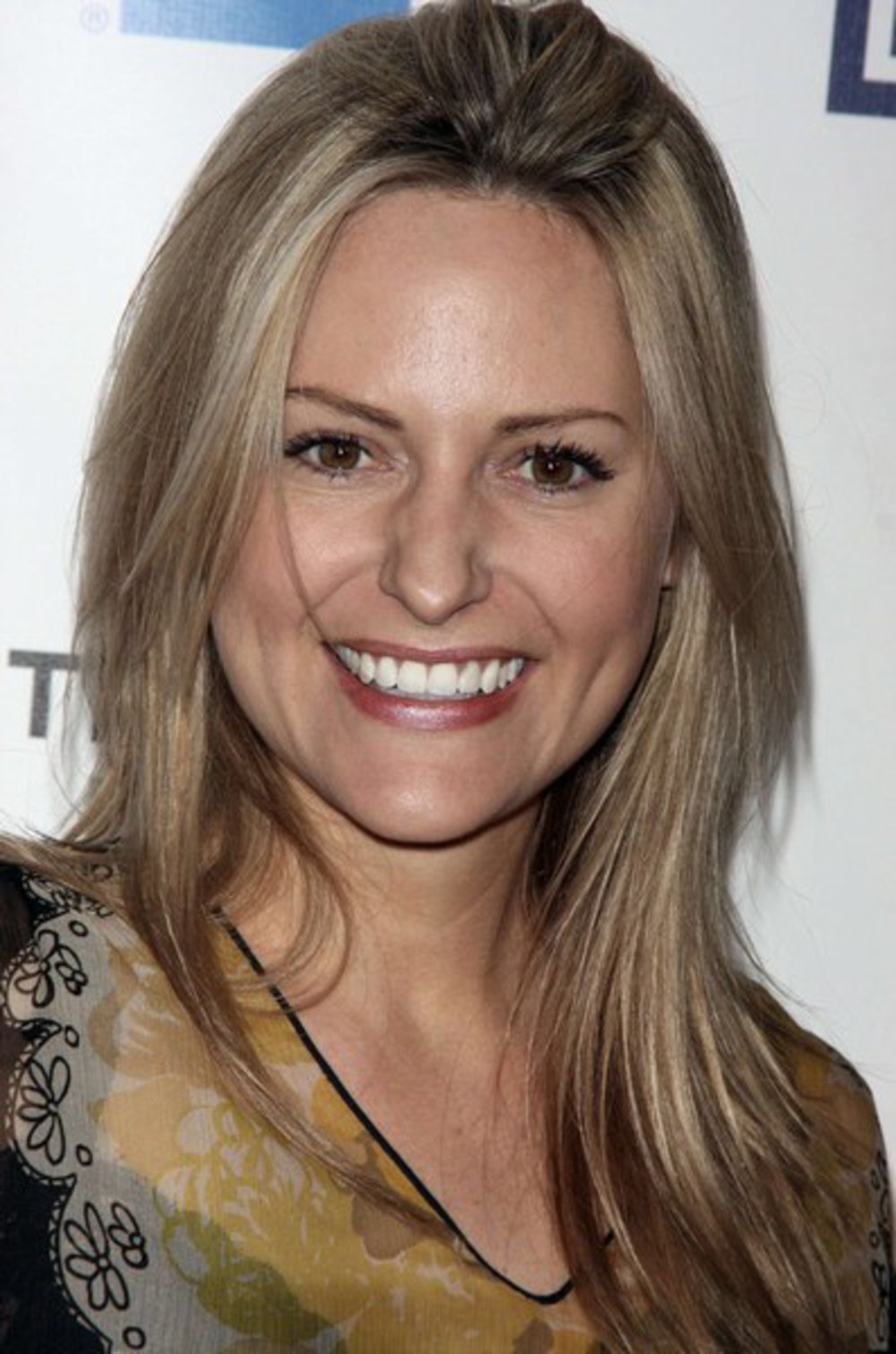 photos-of-aimee-mullins