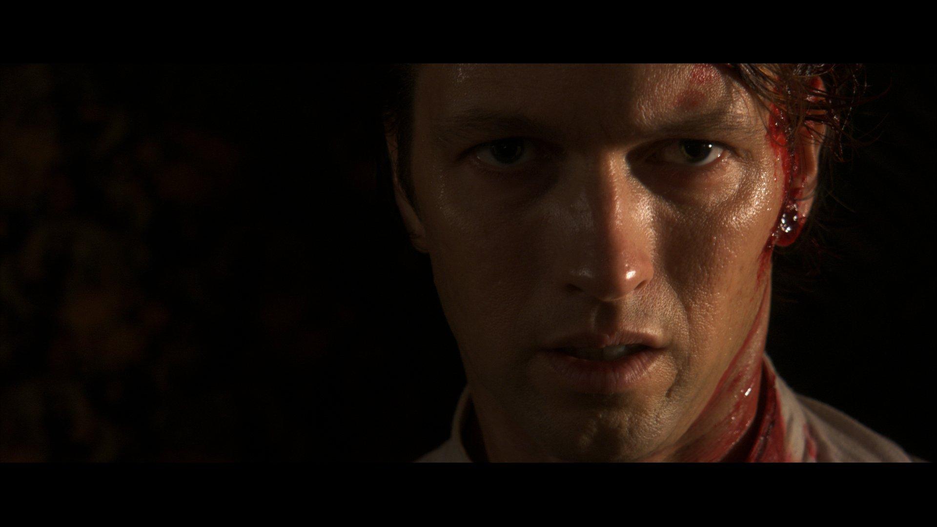 best-pictures-of-aric-cushing