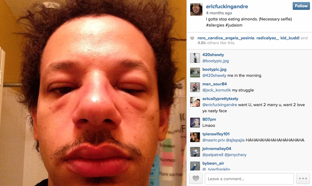 eric-andre-pictures