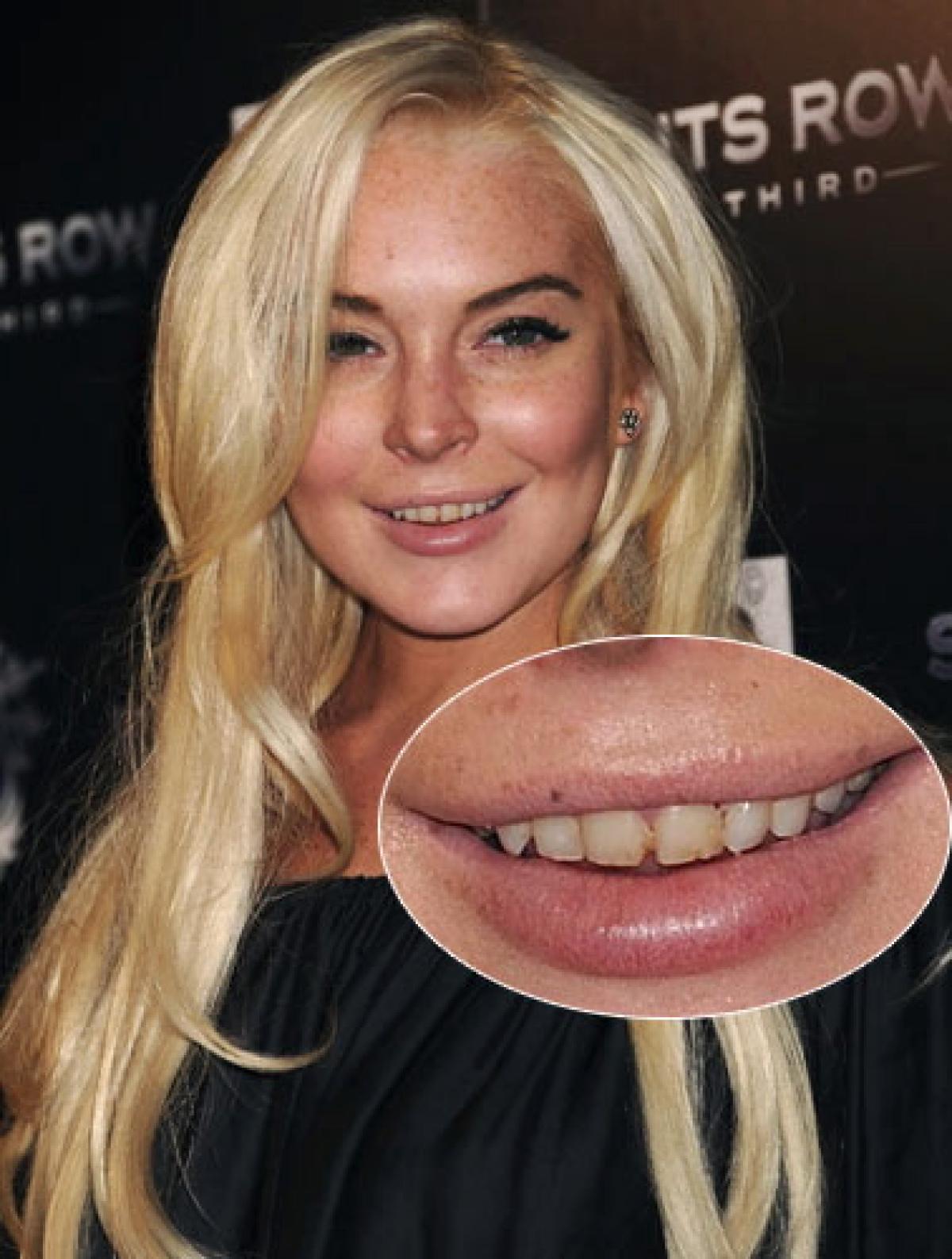 lindsay-lohan-2015